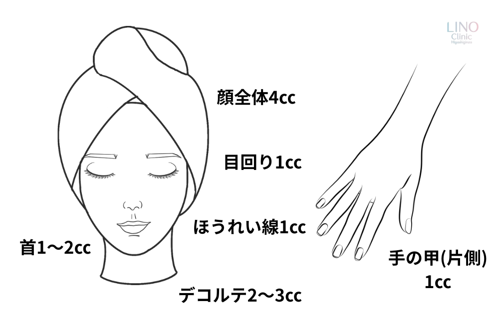 線維芽細胞療法の治療回数や必要量を解説