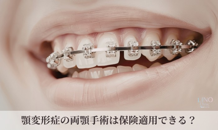 顎変形症の両顎手術は保険適用できる？自費診療との違いを医師が解説