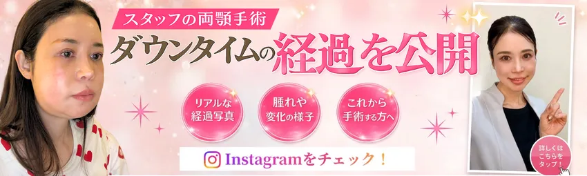 スタッフの両顎手術 ダウンタイムの経過を公開
