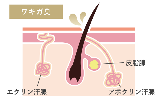 ワキガ手術（腋臭症手術）