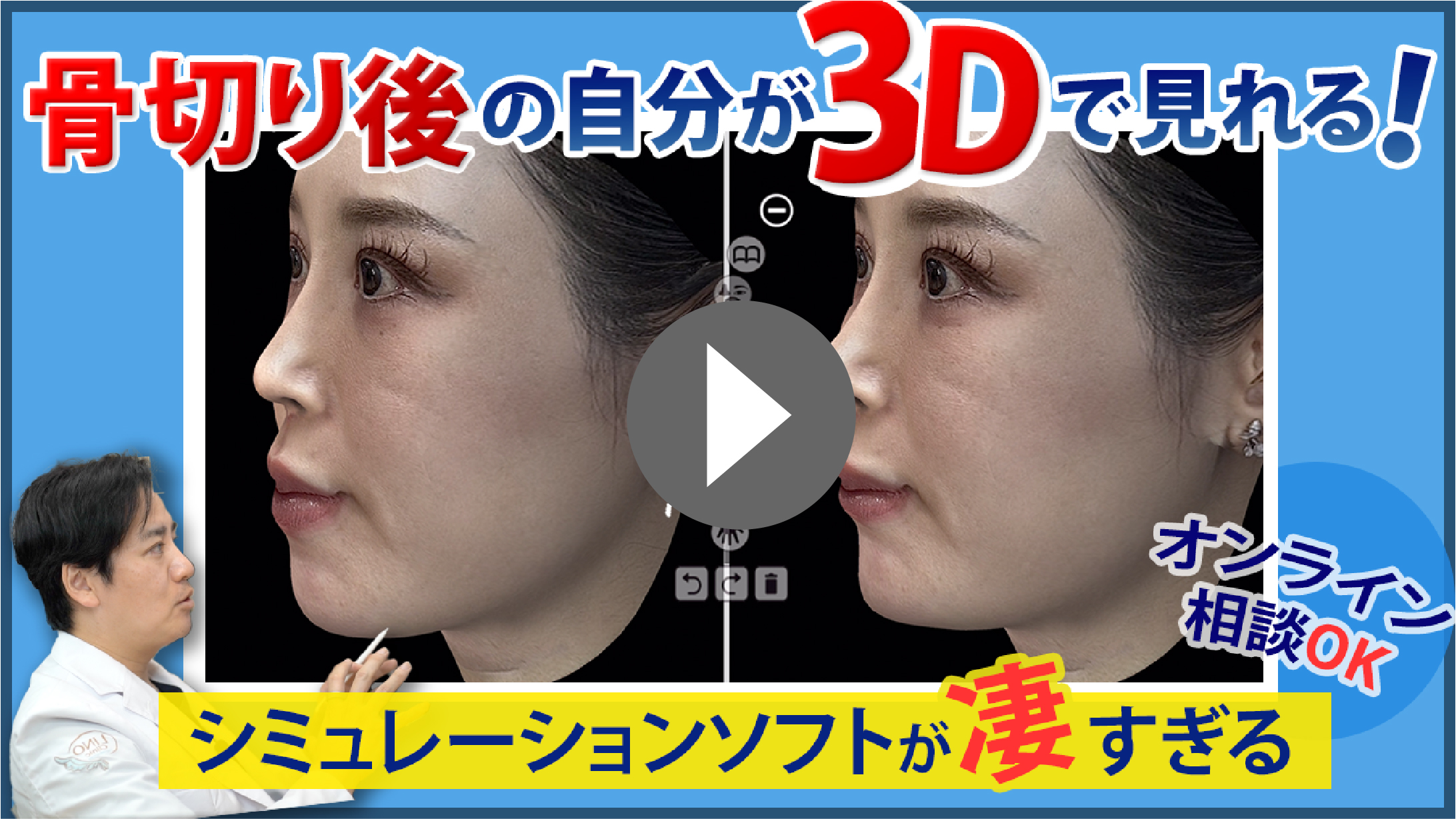 Crisalix（クリサリクス）の解説動画はこちら
