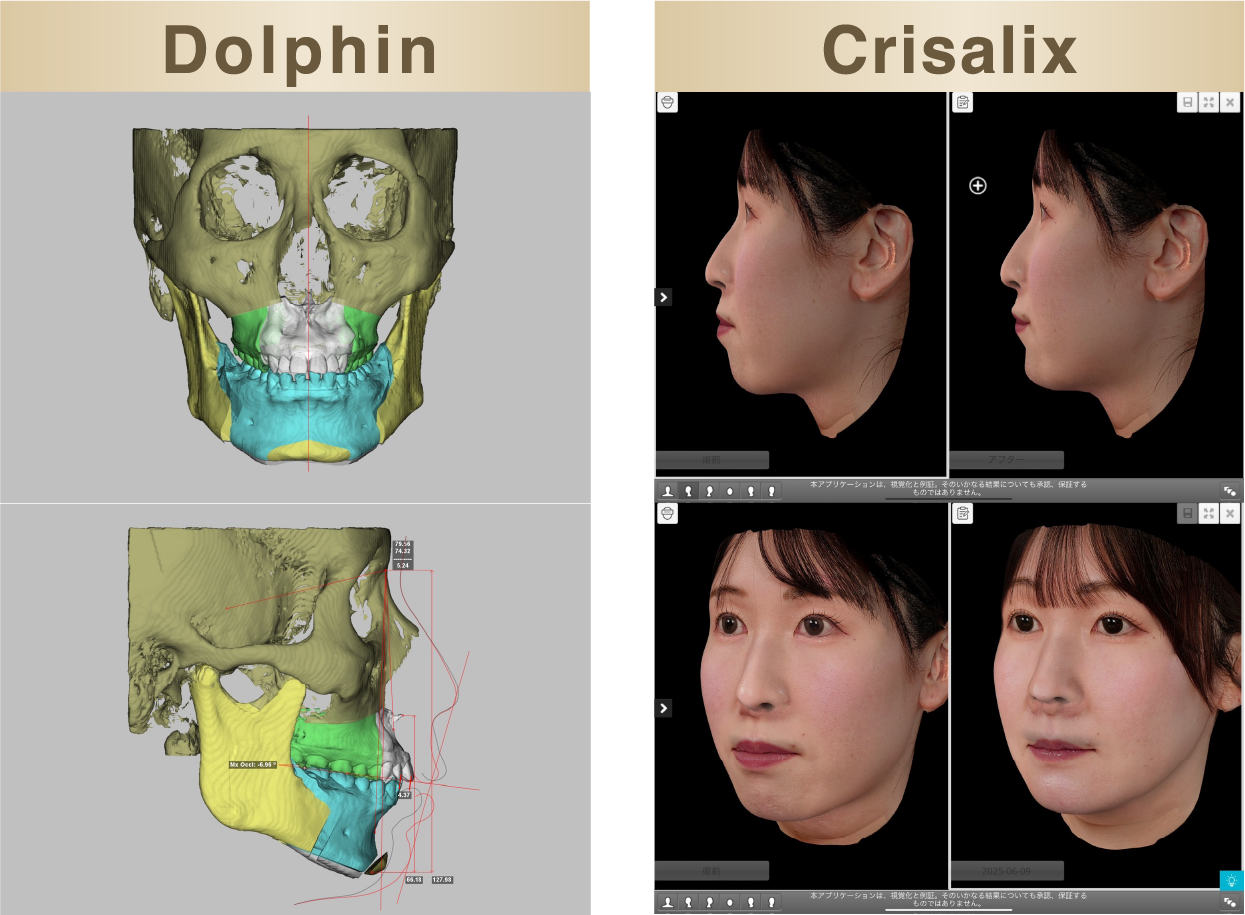 差し替え