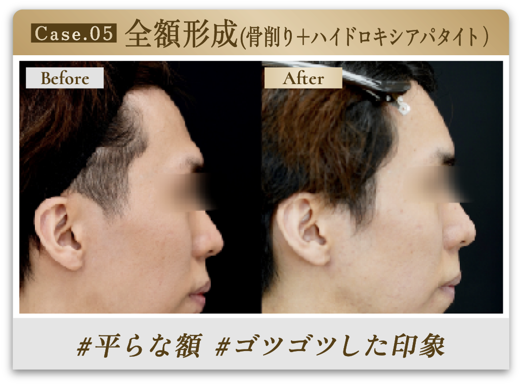 #平らな額 #ゴツゴツした印象
