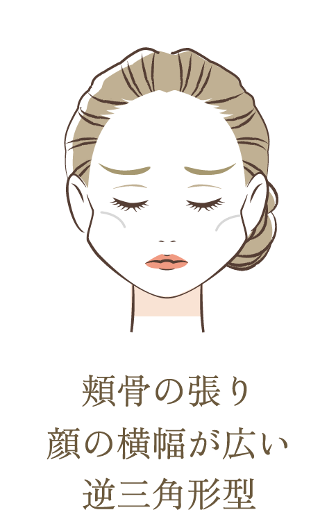 頬骨の張り顔の横幅が広い逆三角形型